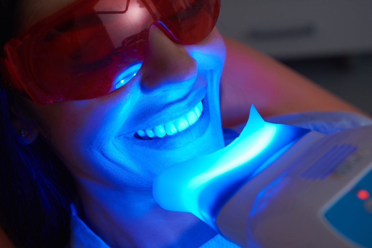 teeth whitening in Riverview
