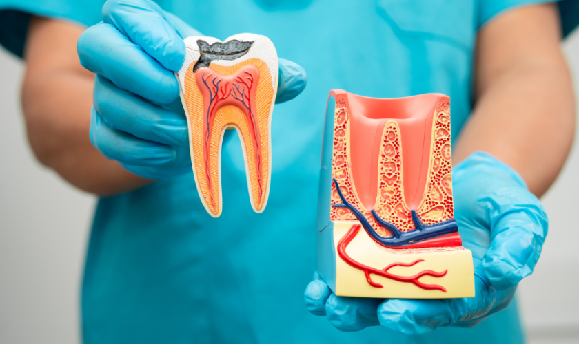 close-up of root canal treatment at Valley Dental Riverview