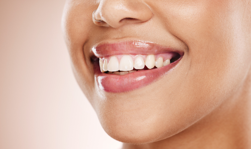 Bride-to-be enjoying her new smile makeover at Valley Dental Riverview before getting married at a Hillsborough River wedding venue with bright healthy teeth.